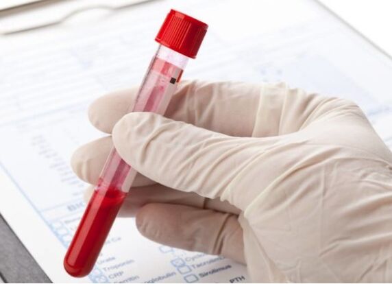 Laboratorní diagnostické metody vám umožňují identifikovat patologickou mikroflóru nebo virus